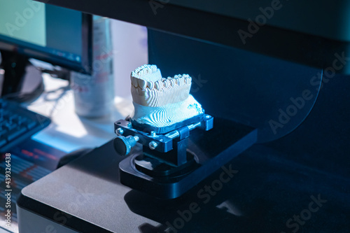 Dental 3D scanner. Close-up of a dental scan with prosthesis. It is designed to create three-dimensional model of prosthesis. Dentist scanner in a dental laboratory. Scanner for dentist technician.