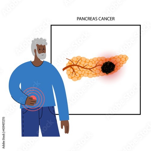 Pancreas disease and cancer