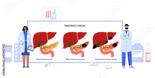 Pancreas disease and cancer