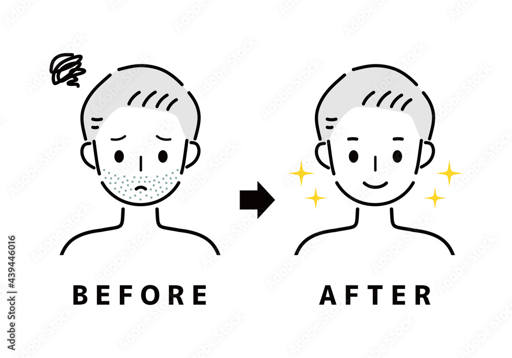 Naklejka premium 男性 ひげ ビフォー アフター