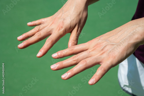 Close up of woman showing her bulging hand veins. Bulging veins can occur due to temporarily rising blood pressure or body temperature when you're exercising or working. photo