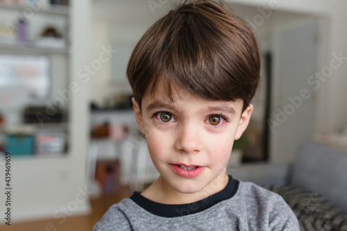 young boy with pink eye photo