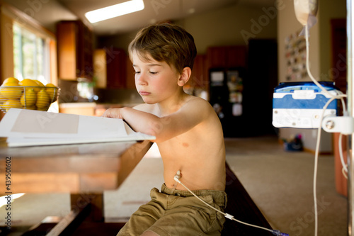 Boy sits at dining room table with pump attached to g-tube port photo