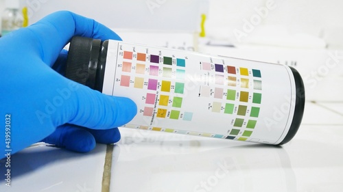 Srip test urinalysis in laboratory. photo