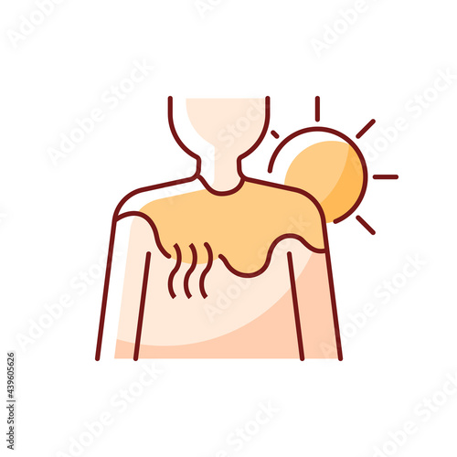 Sunburn RGB color icon. Person under sunlight exposure. Inflammation during summer from heatstroke. Irritation on skin. Isolated vector illustration. Heat stroke simple filled line drawing