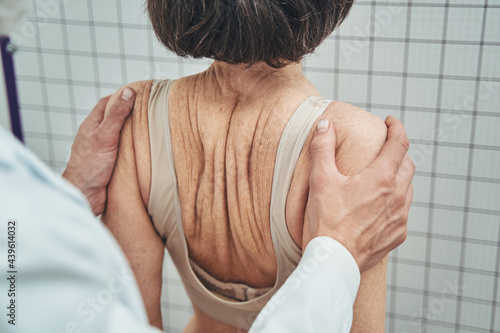 Physician testing a woman for scoliosis in the standing position photo