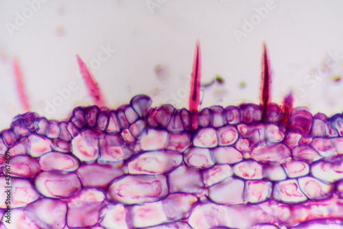 gallnut plant cells micrograph photo