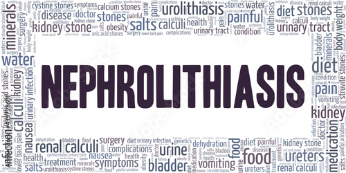 Nephrolithiasis vector illustration word cloud isolated on a white background.