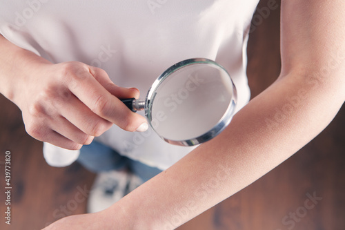 woman examines her hand with a magnifying glass