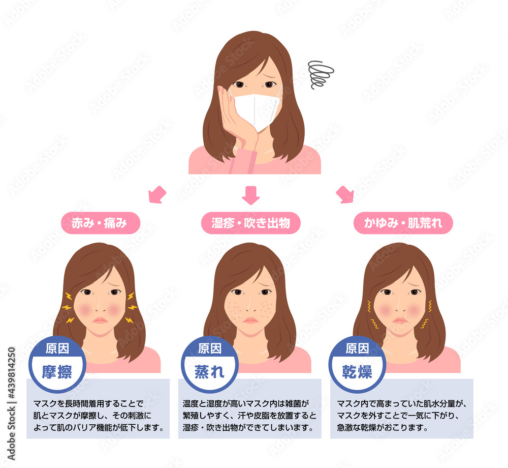 マスク着用による肌トラブルのイラスト スキンケア 新型コロナウイルス Stock Vector Adobe Stock