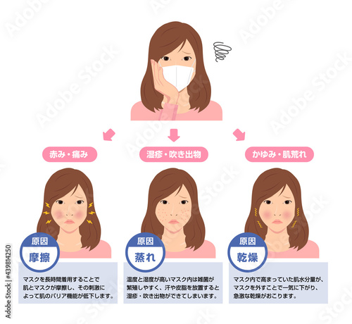 マスク着用による肌トラブルのイラスト / スキンケア (新型コロナウイルス)