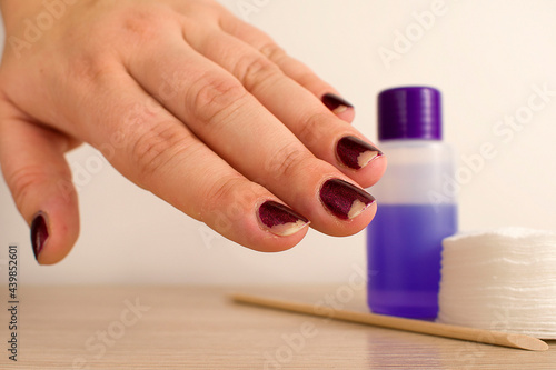 Damaged female manicure. Peeled polish with nails. Home manicure concept. Home manicure in quarantine. Dry skin with brittle splitting 