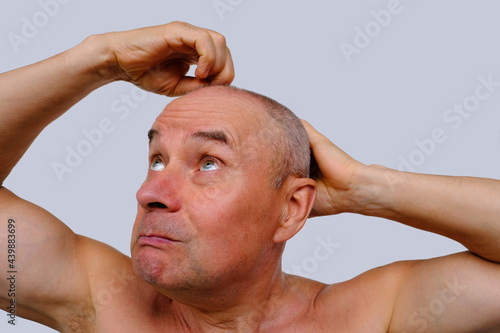 old man grabbed his head, senior upset because of lack of hair, concept of hair loss and extension, baldness, skin treatment, health of the elderly, age-related changes