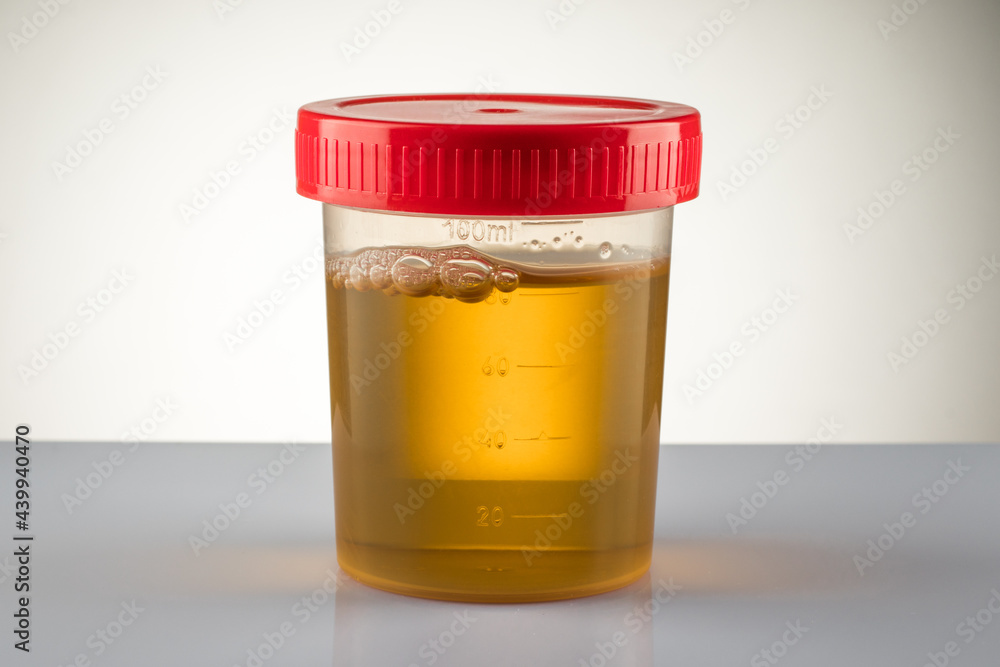 Fotografía Container with collected sample