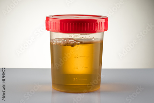 Foto Container with collected sample