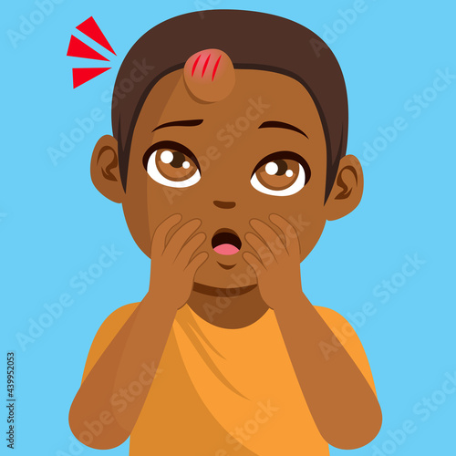Cute little black toddler boy with big bump injury on forehead