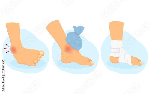 Tableau sur toile sprain