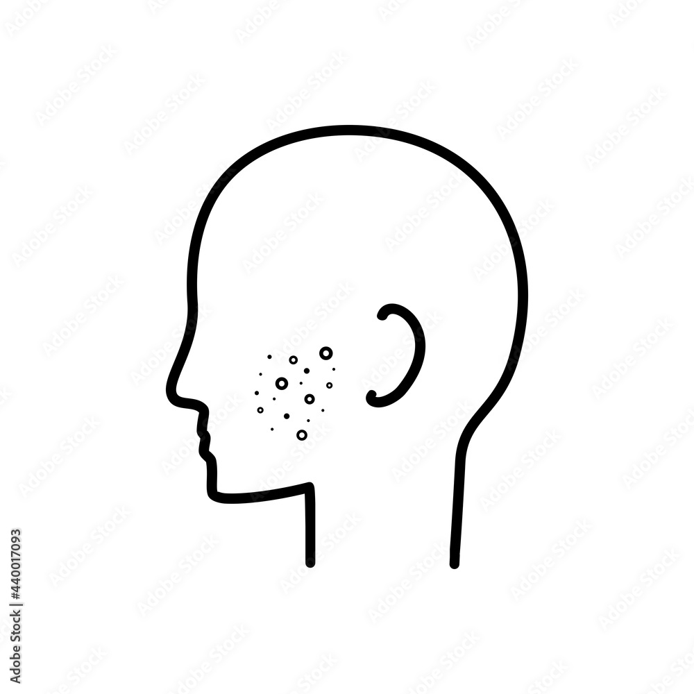 Man silhouette with acne on face. Pimple on face. Illustration vector Man silhouette with acne on face. Pimple on face. Illustration vector