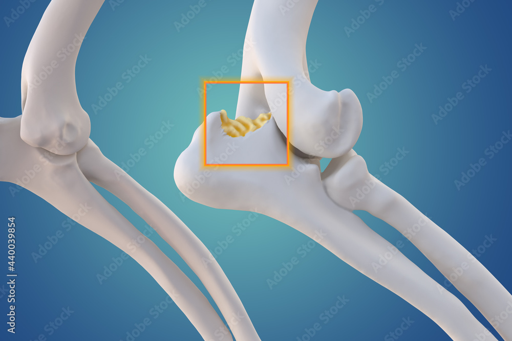 Canine Arthritis and Osteoarthritis joint inflammation Stock ...