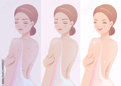 The dark skin gradually became white