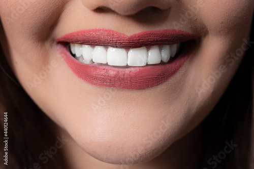 Woman with red lipstick and toothy smile
