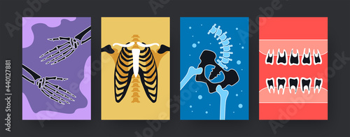 Set of contemporary art posters with X-ray shots of human body. Vector illustration. .Collection of colored X-ray pictures of hands, ribs, pelvis, teeth in bright background. Medicine, anatomy concept