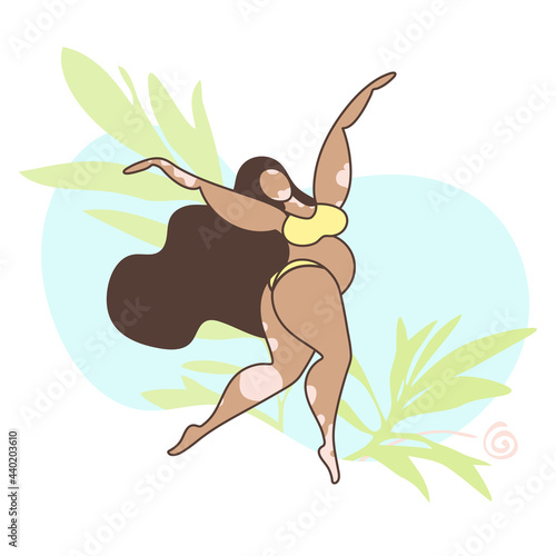 Happy plus size girl dancing raising her hands up on the background of the sea. Attractive overweight tanned woman with Vitiligo disease. Love for your body. Brunette with long hair in a yellow bikini