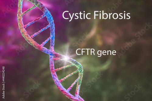 Cystic fibrosis, a genetic disorder caused by mutation in the CFTR gene, 3D illustration photo