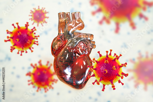 COVID-19 viruses affecting the heart, conceptual 3D illustration photo