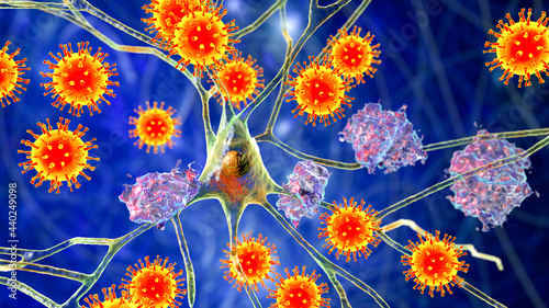 Obraz na plátně Infectious etiology of dementia. Viruses that affect neurons