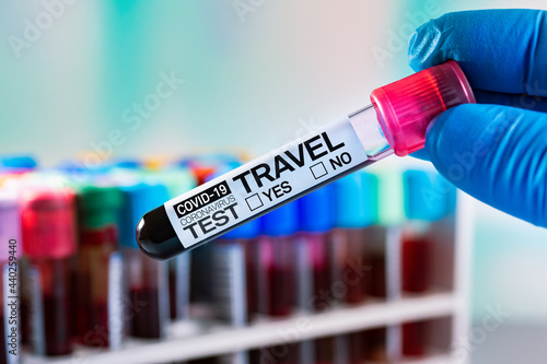 Serological Blood analysis of patient for covid-19 antibodies test that will validate him for a trip. Blood tube labeled with the name Covid-19 Coronavirus Test, Travel Yes or No