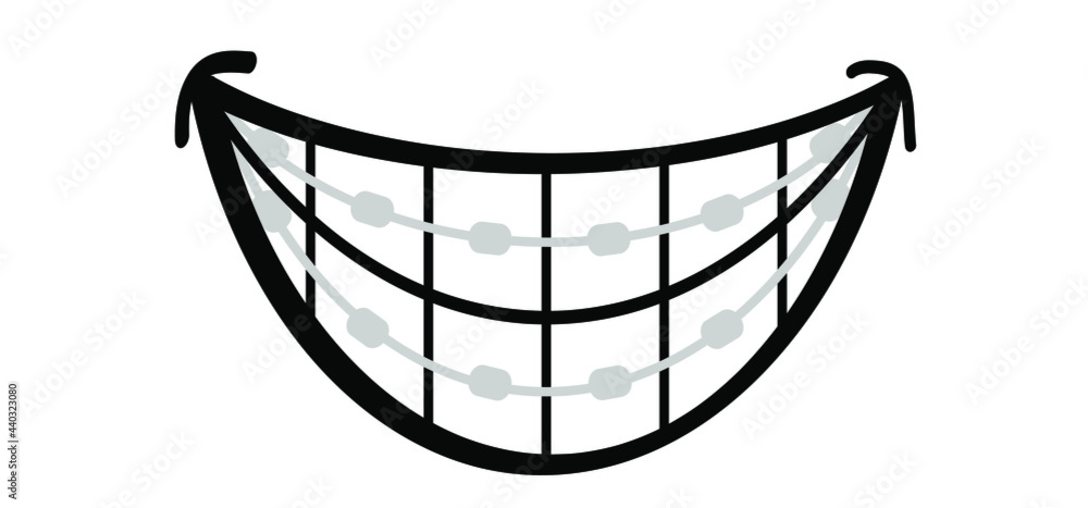 Happy smile with teeth and braces. Orthodontic dental care bracket. Cartoon, flat vector thoughts pictogram. Orthodontic dental care bracket or brace.Teeth dentist, Braces Happy smile with teeth and braces. Orthodontic dental care bracket. Cartoon, flat vector thoughts pictogram. Orthodontic dental care bracket or brace.Teeth dentist, Braces