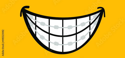 Happy smile with teeth and braces. Orthodontic dental care bracket. Cartoon, flat vector thoughts pictogram. Orthodontic dental care bracket or brace.Teeth dentist, Braces