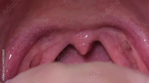 Close to the inside of the human mouth.