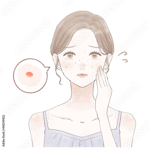 ニキビを気にする女性