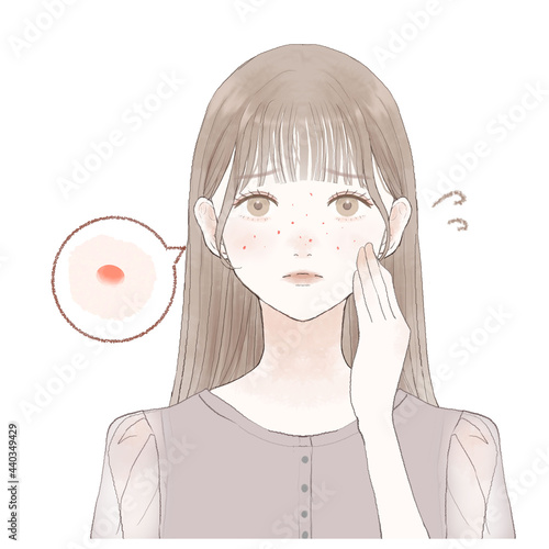 ニキビを気にする女性