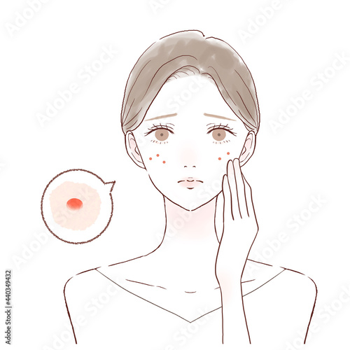 ニキビを気にする女性