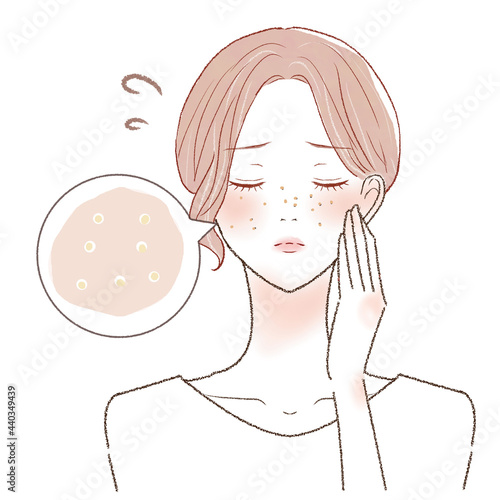 詰まり毛穴に悩む女性