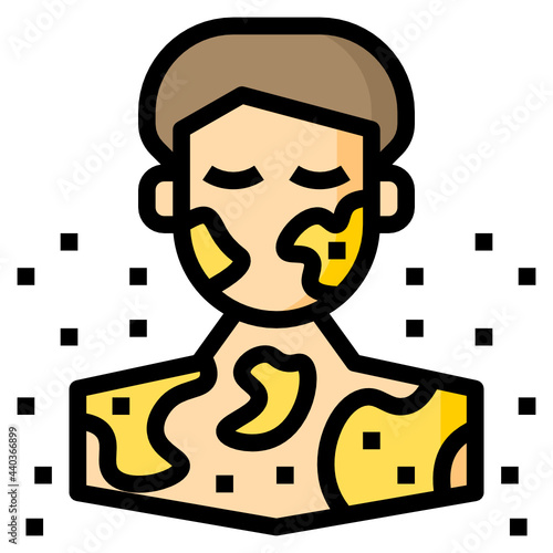Anaphylaxis