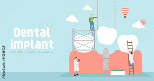 Dental implant concept vector banner illustration