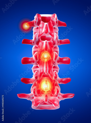 lumbar photo