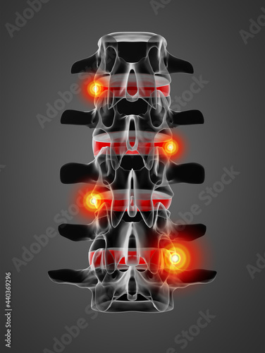 3D rendering illustration of intervertebral discs photo