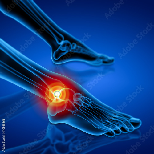 Human foot pain with the anatomy of a skeleton foot