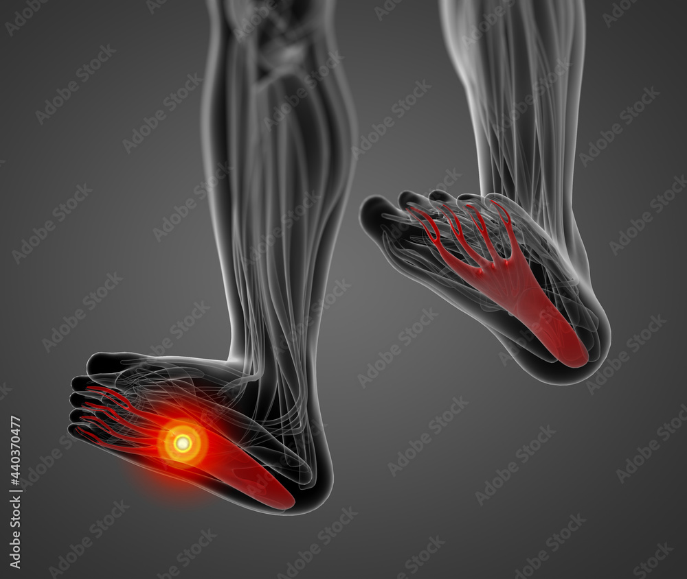 medical illustration of the flexor digitorum brevis Stock Illustration ...