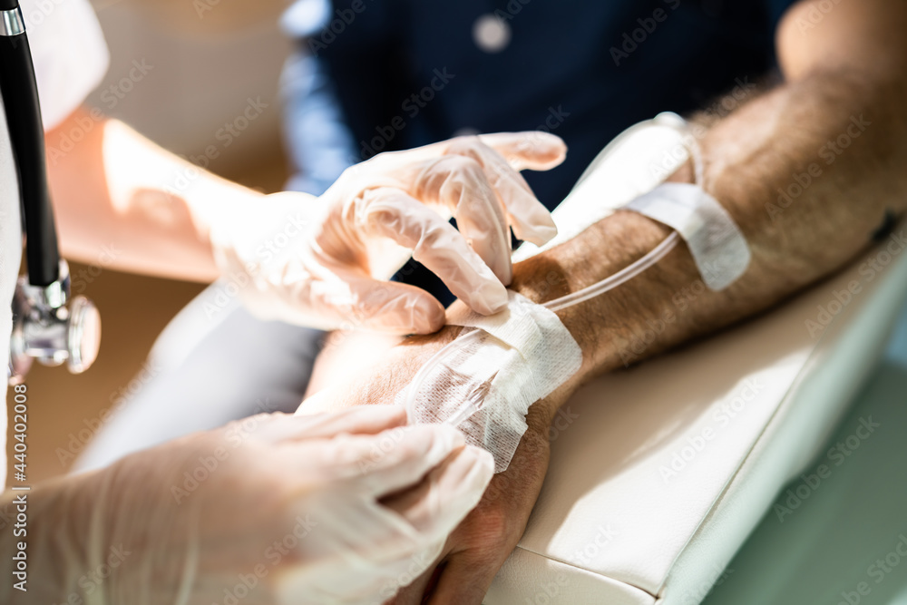 Obraz premium Nurse Or Doctor Examines Oncology Patient Catheter
