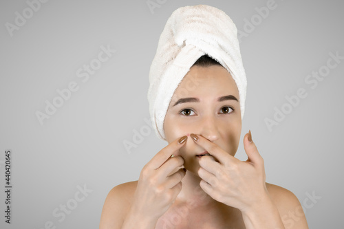 A woman with a towel on her head squeezes pimples on her face.