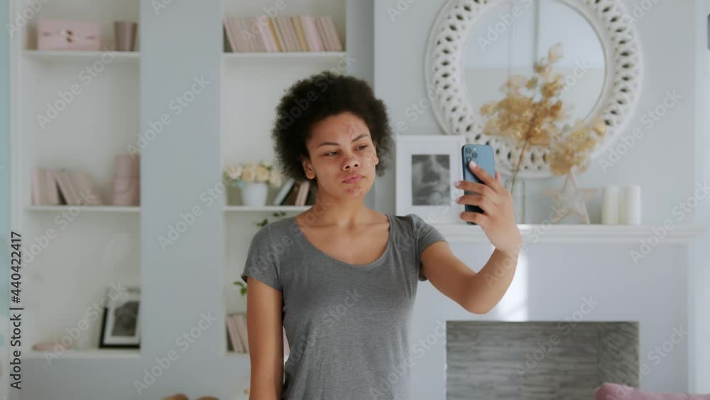 African American Girl with Problem Skin Looks at the Camera Like in a Mirror Using App on Mobile Phone. Young Woman Touching the Screen and Posing in Front of the Phone. Skin Care Application Concept. African American Girl with Problem Skin Looks at the Camera Like in a Mirror Using App on Mobile Phone. Young Woman Touching the Screen and Posing in Front of the Phone. Skin Care Application Concept.