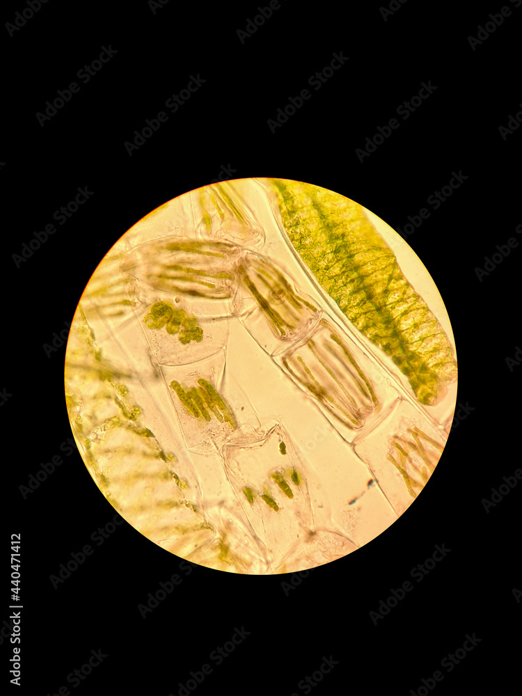Dirty water sample under a microscope. Algae zignema and spirogyra ภาพถ่ายสต็อก Adobe Stock