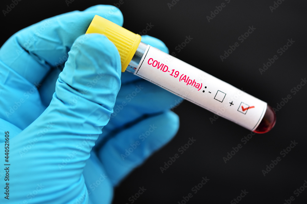 Obraz premium Alpha variant COVID-19 positive, blood sample tube positive with Alpha variant or UK strain COVID-19 