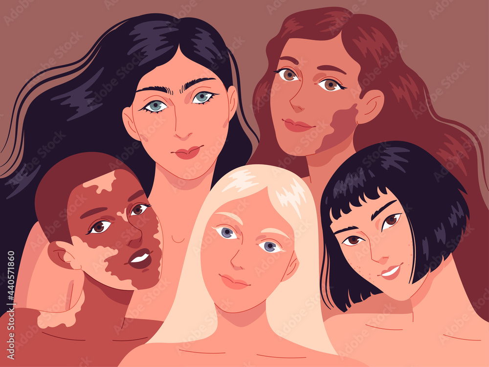 Portrait of young women with different skin types.